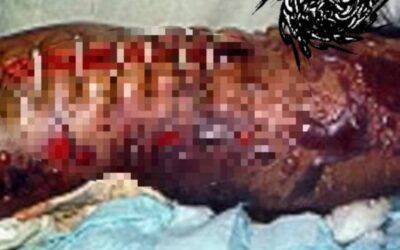 AUTOZOOFILIA ANTROPOFAGOLAGNICA: Podridura Humana