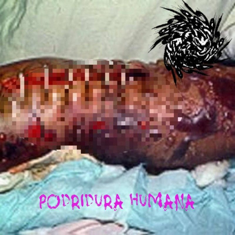 a4030787683_16 Podridura humana Autozoofilia Antropofagolagnica